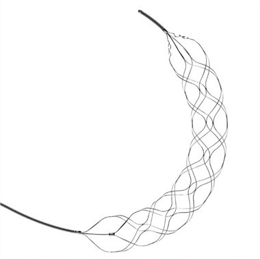 Retrievable Stent Thrombectomy